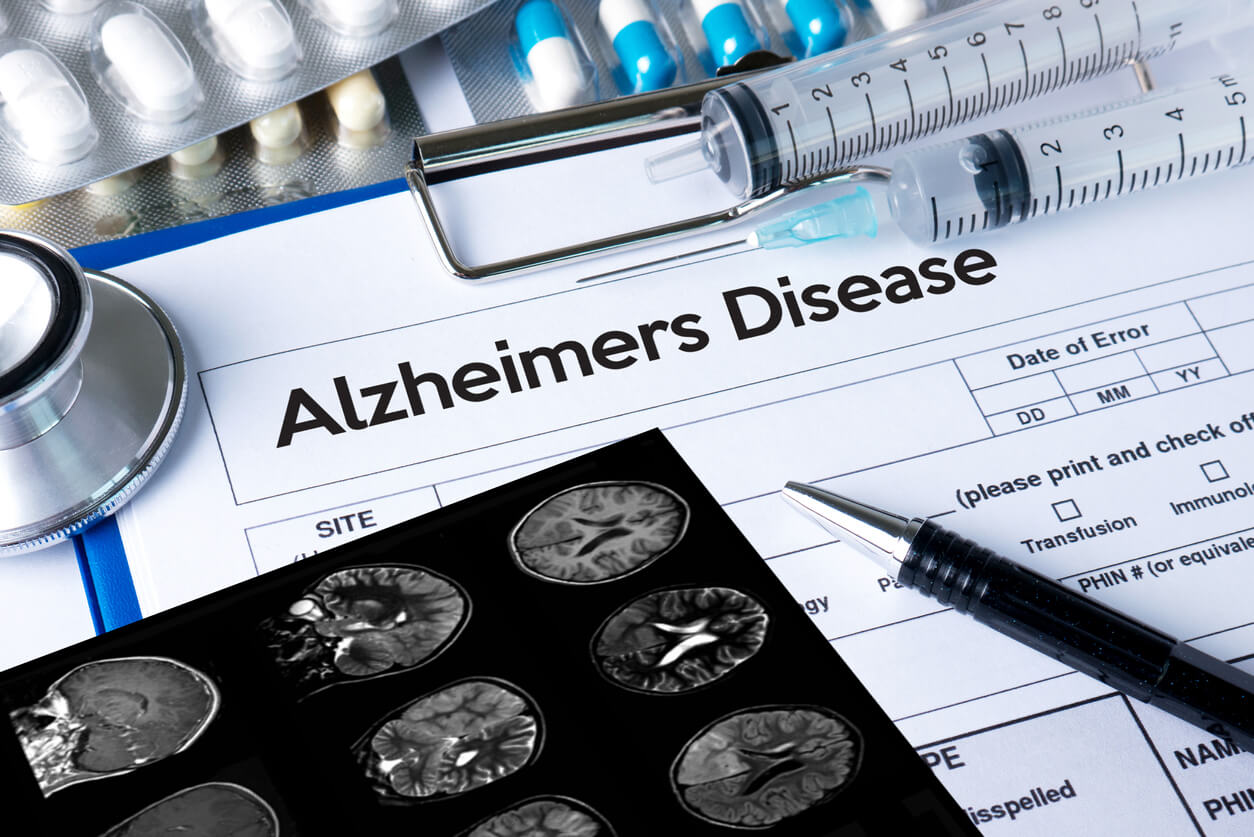 medical marijuana for alzheimer's